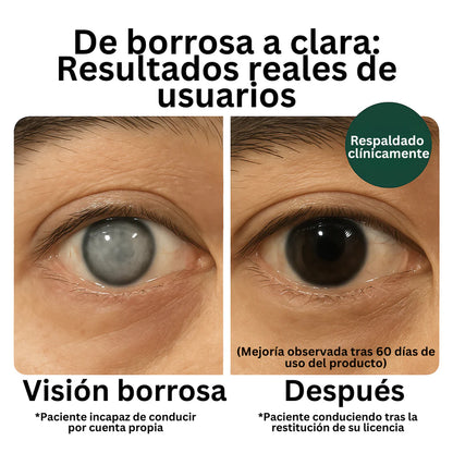 Zoone Luteina Vitaminas para los Ojos
